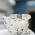 Revolutionize Your Oral Health Journey: Teeth Implants In Gainesville, VA, With TENS In Dentistry