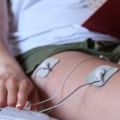 Can Pregnant Women Receive TENS Treatments in Dentistry?