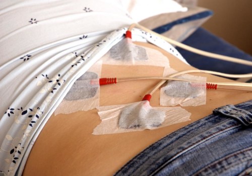 Does a TENS Unit Promote Nerve Healing?