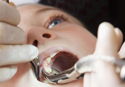 Can Kids Receive TENS Treatments in Dentistry?