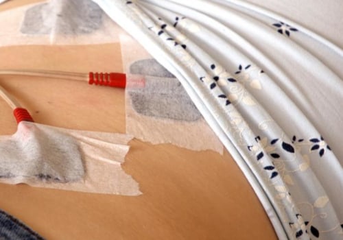 Understanding the Benefits of Transcutaneous Electrical Nerve Stimulation (TENS)